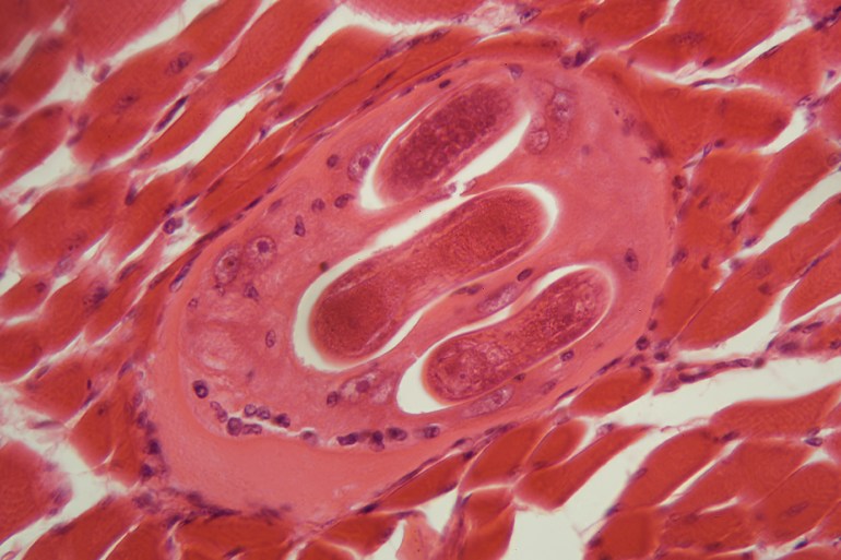 trichinella spiralis larvae in muscle tissue under the microscope. trichinella spiralis is a nematode parasite responsible for trichosis and affecting mammals.